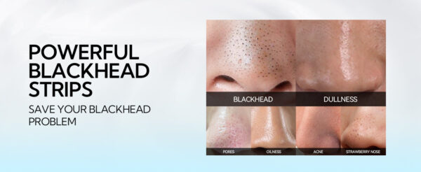 Masque Peel Off Anti-Points Noirs LANBENA - Élimine les Points Noirs du Visage et du Nez