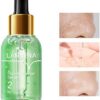 LANBENA Pore Minimizer Serum, Pores Shrinking Serum for Face, Oil Control Firming, Tightening Pores, Vegan Moisture after Blackhead Remover, Centella Asiatica, Hamamelis Virginiana, 0.6 fl.oz