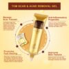 Scar Removal Cream - TCM Scar Cream for Surgical Scars, Acne Skin Care Cream, Acne Treatment Cream for Scars, Burns, Stretch Marks, Acne Spots