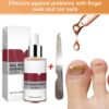Lanbena Nail Repair Essence, Fingernail & Toenail Repair Nail Treatment 0.5fl.oz
