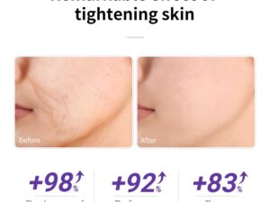 LANBENA Retinol Serum for Face, Retinol Serum with Hyaluronic Acid for Wrinkles and Fine Lines, Renew and Plump Night Facial Serum for Glowing Skin, Serum for Sensitive Skin, 30ml