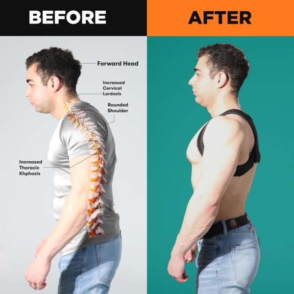 Posture Corrector & Spine Support | Universal Fit Adjustable Upper Back Brace For Clavicle To Support Neck, Back and Shoulder Pain Relief Kyphosis Straightener
