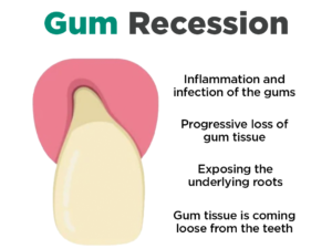 Stylo de blanchiment des dents JaySuing™