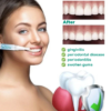 JaySuing™ Teeth Whitening Pen