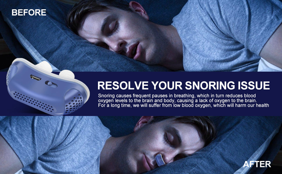 Double Vortex Anti Snoring Device - Effective Snoring Solution