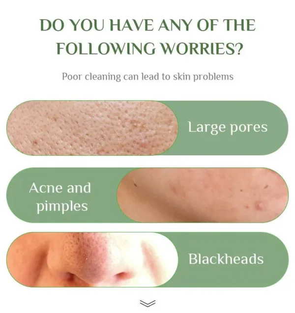 Anti-Blackhead Green Tea Miracle Stick - Removes Blackheads from Face and Nose