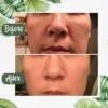 Anti-Blackhead Green Tea Miracle Stick - Removes Blackheads from Face and Nose