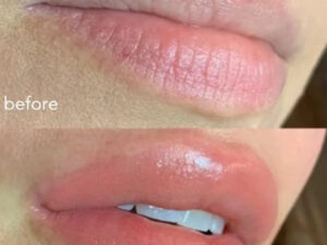 Moisturizing Fruit Glossy Lip Plumper